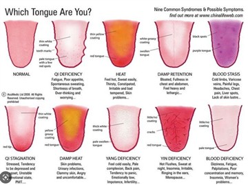 UN articol despre diagrama de culori Gua Sha
